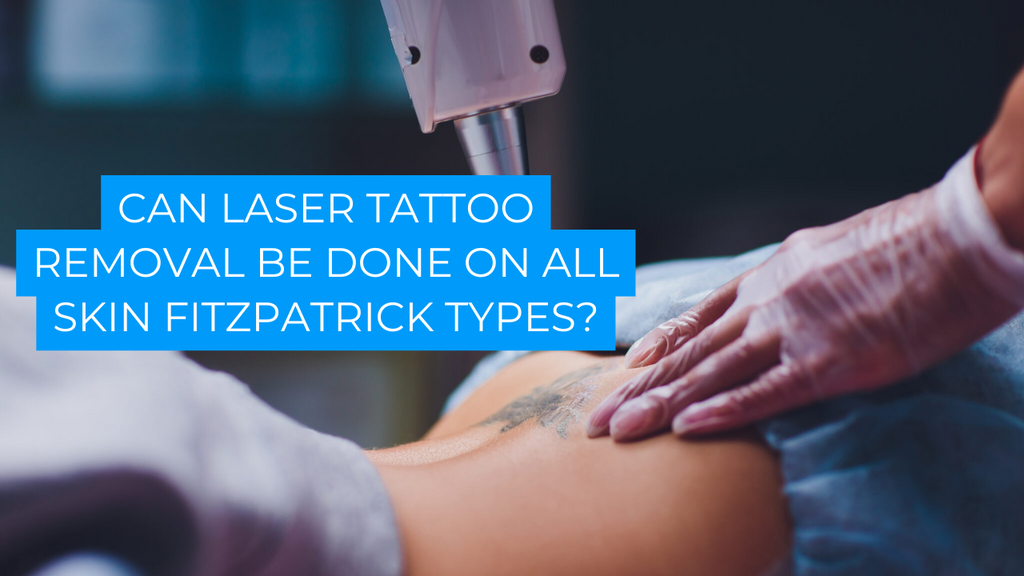 Can Laser Tattoo Removal be done on all Skin Fitzpatrick Types?